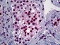 YY1 Antibody (clone 4D2)